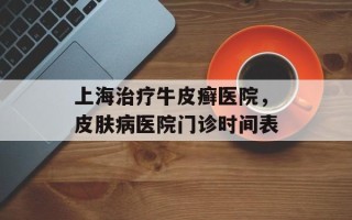 上海治疗牛皮癣医院，皮肤病医院门诊时间表