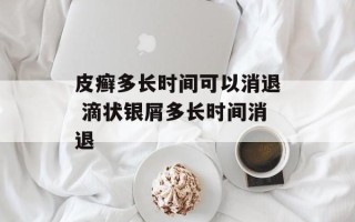 皮癣多长时间可以消退 滴状银屑多长时间消退
