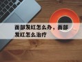 面部发红怎么办，面部发红怎么治疗